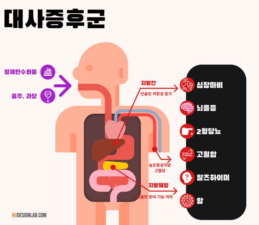 대사증후군