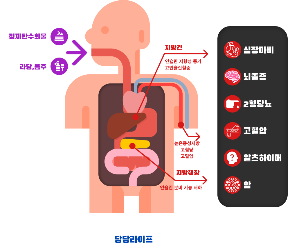 대사증후군 원인 과 결과