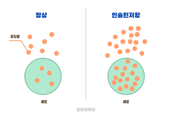 인슐린저항성 원인